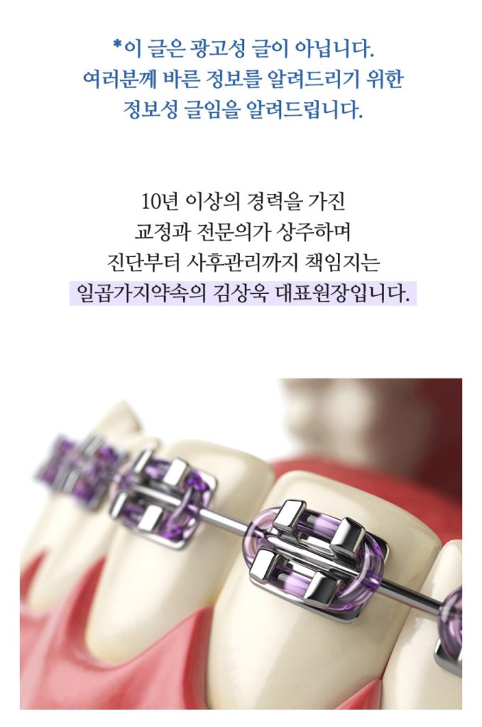 임플란트 복붙이미지 (1)