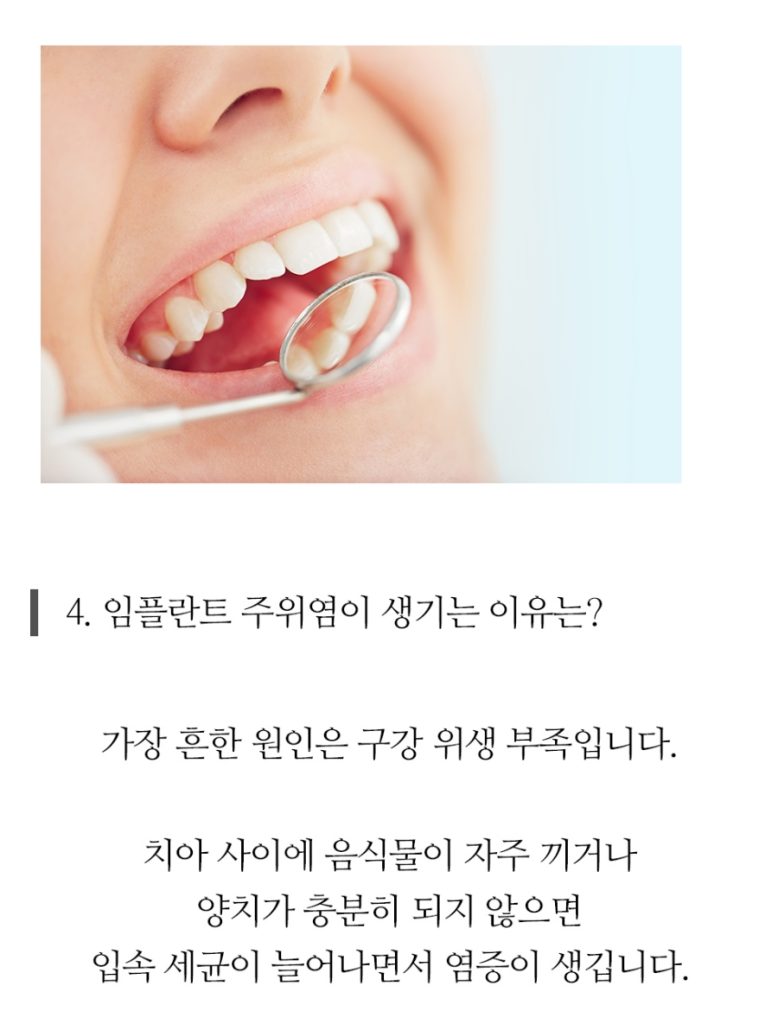 임플란트 복붙이미지 2 (15)