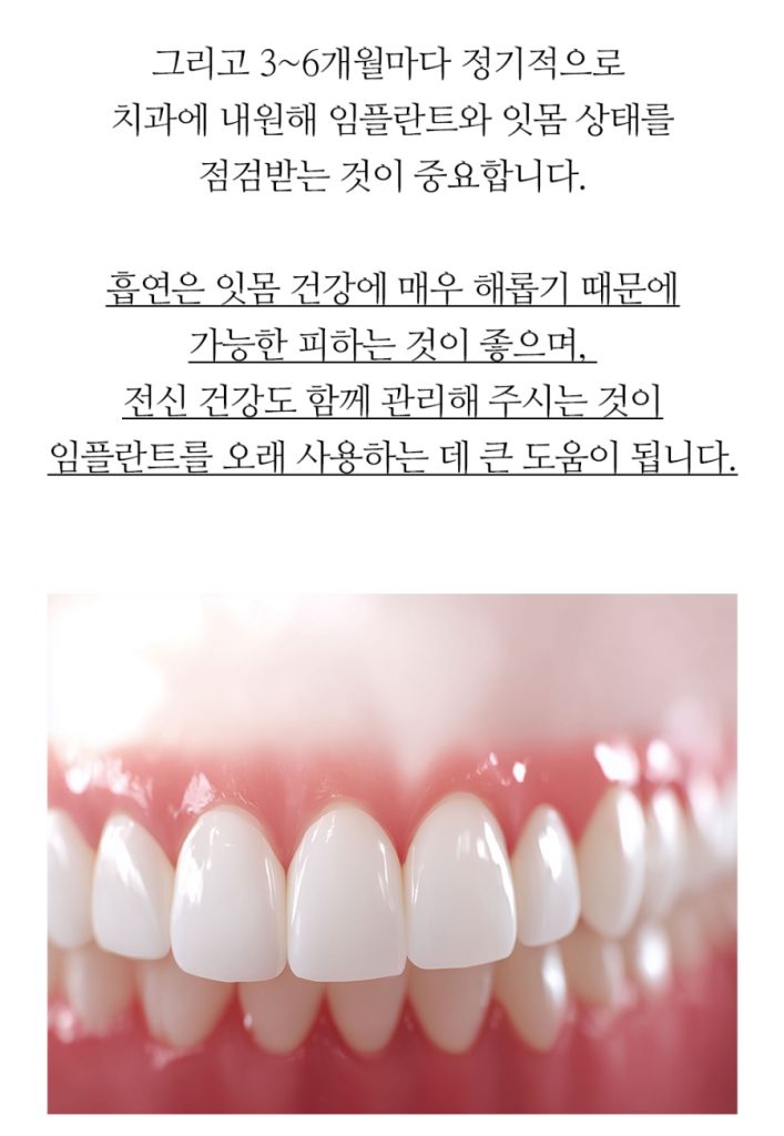 임플란트 복붙이미지 2 (22)