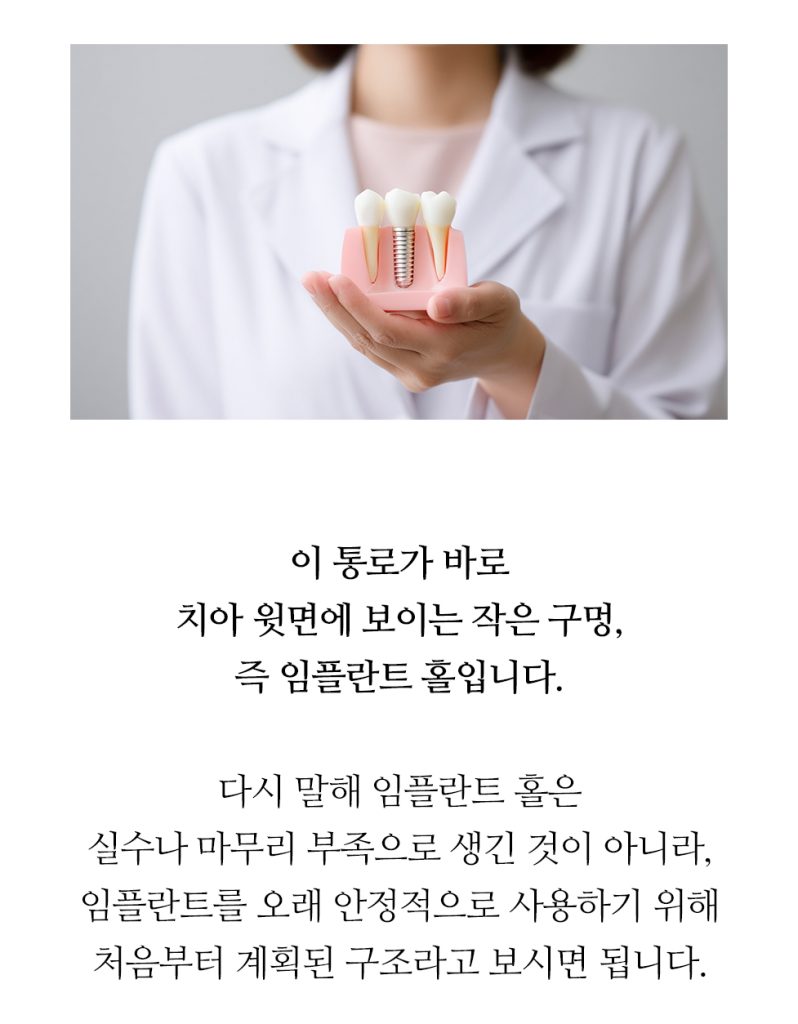 임플란트 복붙이미지 2 (4)