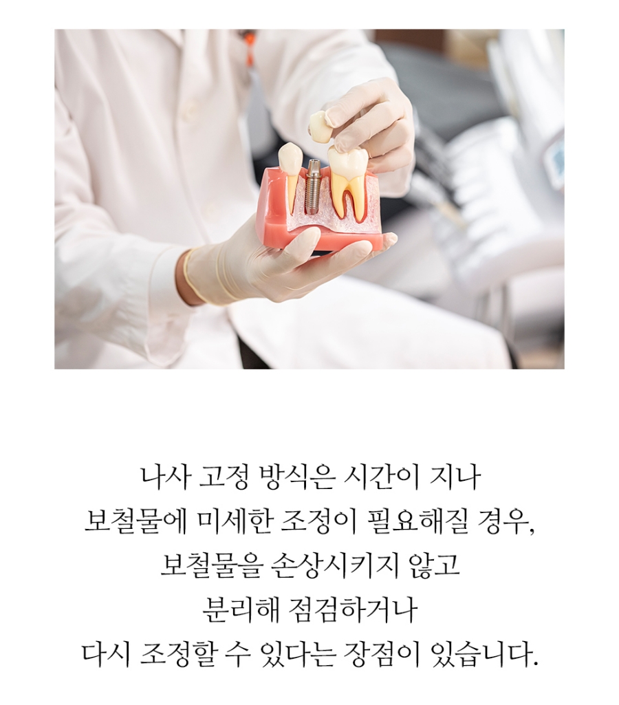 임플란트 복붙이미지 2 (6)