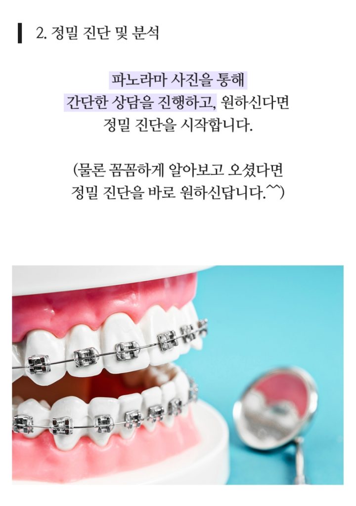 임플란트 복붙이미지 (6)