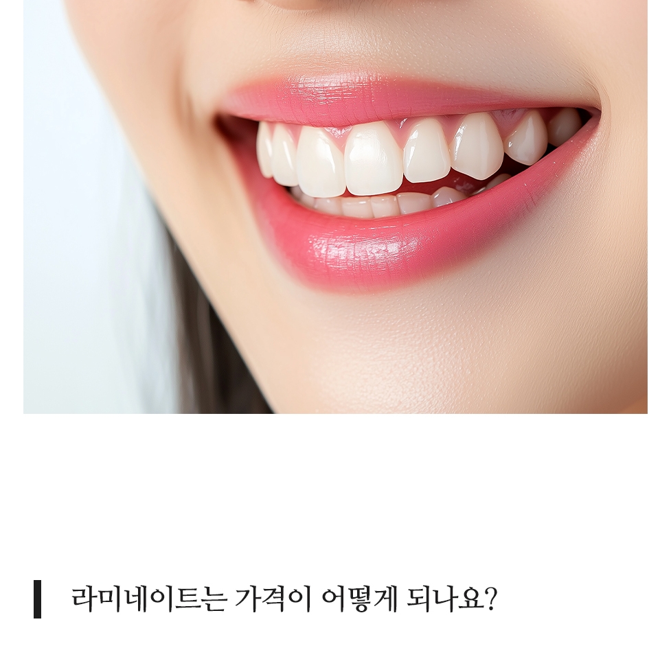 라미네이트 이미지 (14) 라미네이트 이미지 14