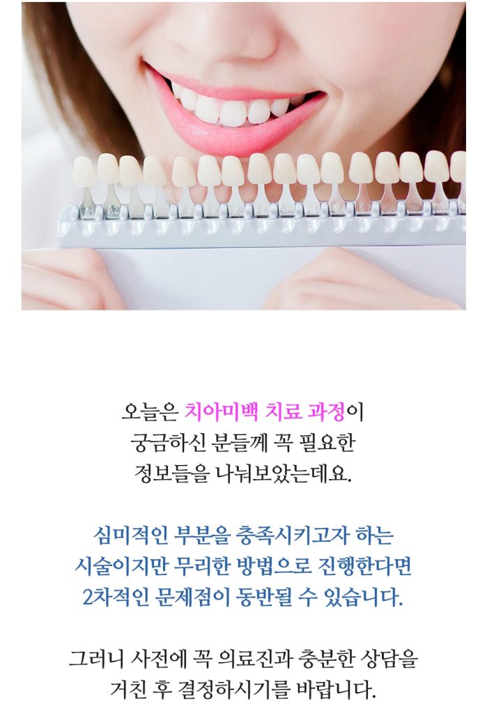 치아미백 이미지 (11)