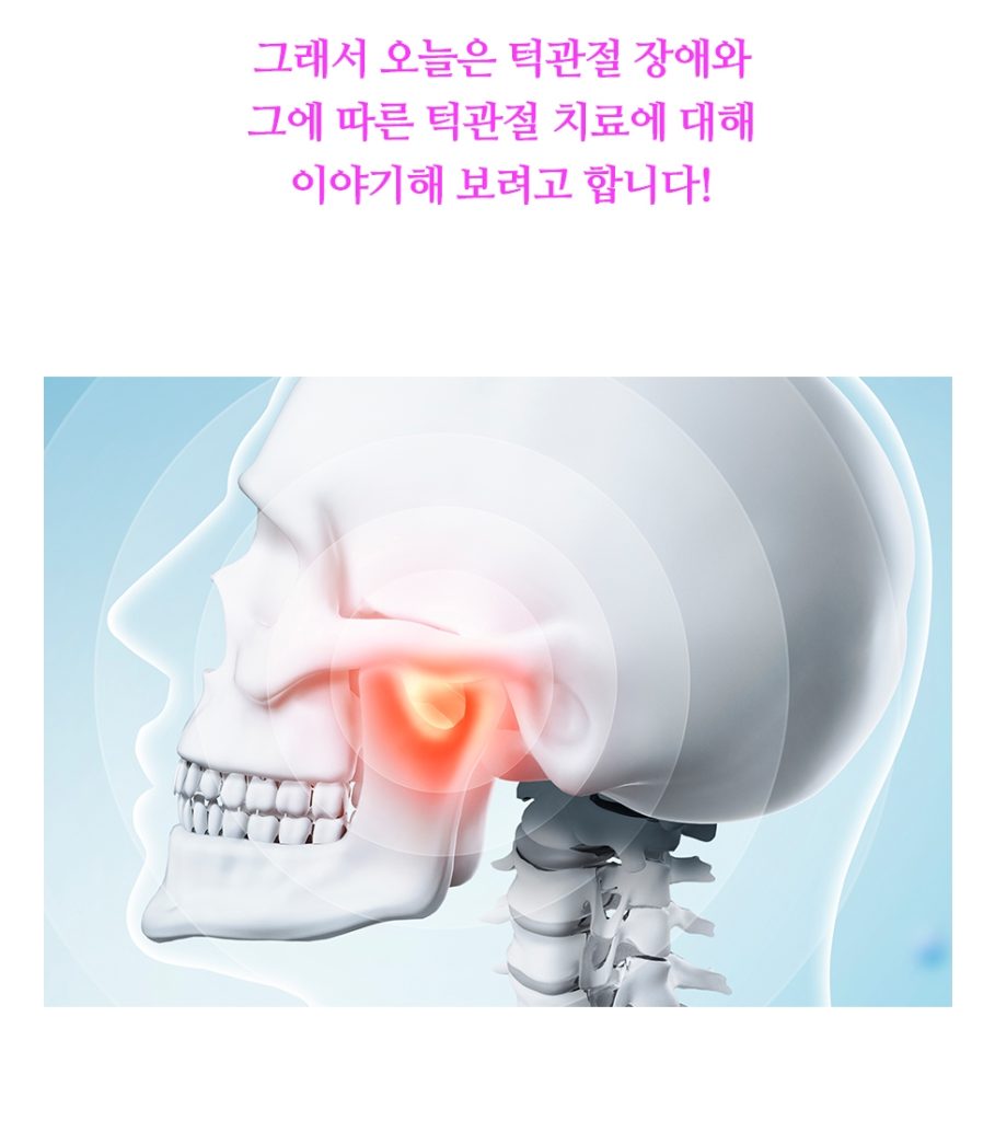턱관절 이미지 2 909x1024