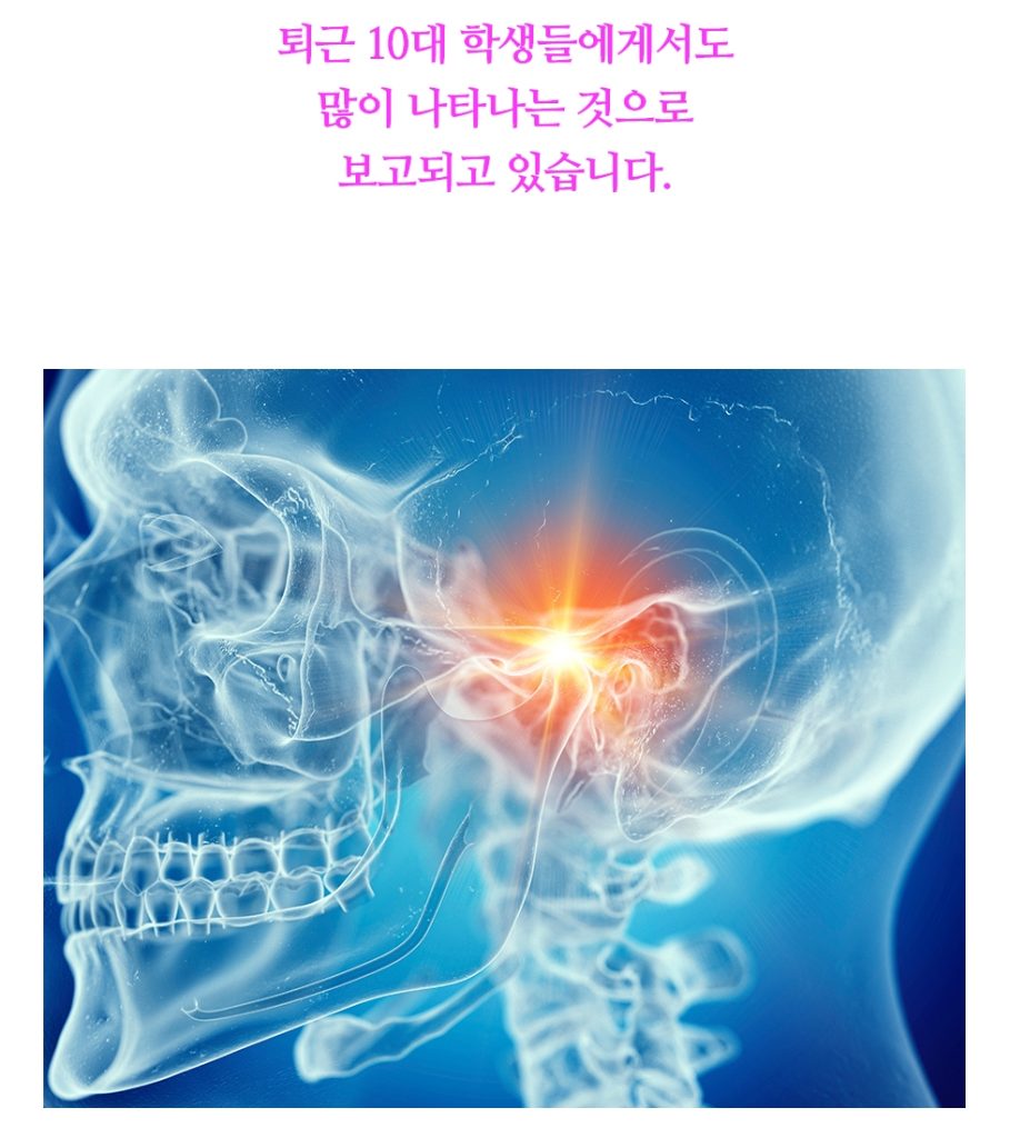 턱관절 이미지 4 909x1024